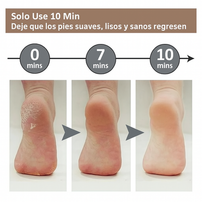 Removedor De Callos Electrico Lima