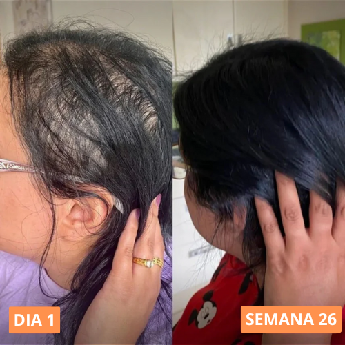 Aceite de Semilla de Calabaza