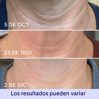 GO PURE™ - LEVANTA TU PIEL