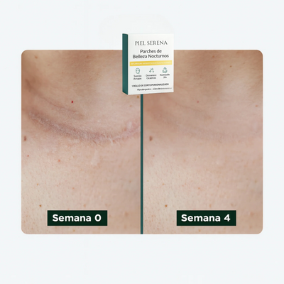 Skinoa - Cinta Para Cicatrices (3M)